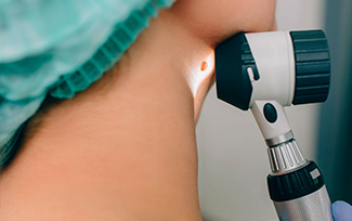 Удаление папиллом в Долгопрудном Удаление папиллом в Долгопрудном